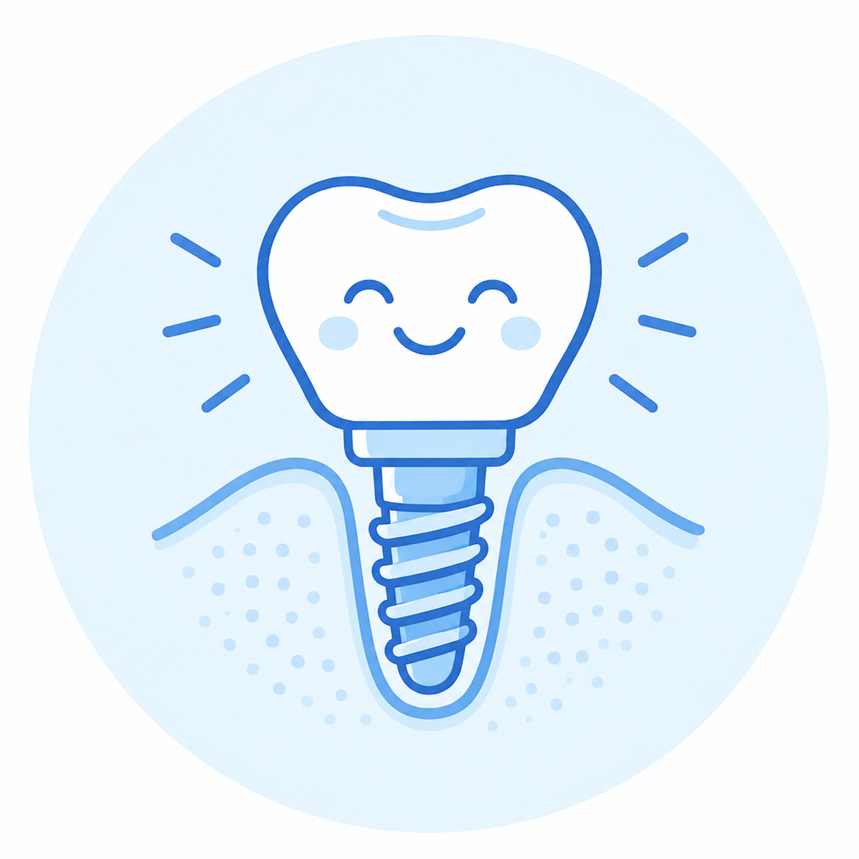 Dental Implants